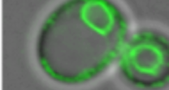 Fluorescent microscope image of mother and daughter cells